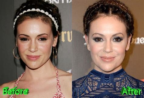 wiki alyssa milano|alyssa milano before and after.